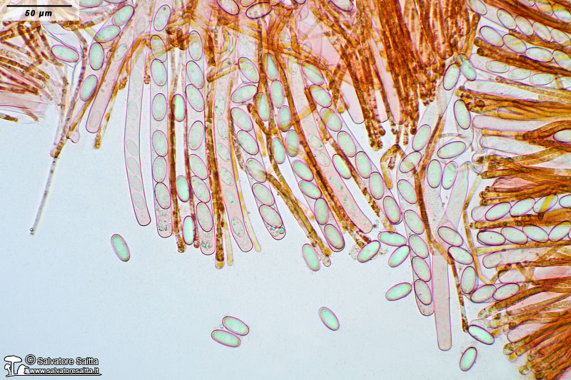 Cheilymenia stercorea aschi e parafisi foto 1