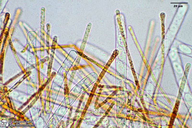 Cheilymenia stercorea aschi e parafisi foto 2