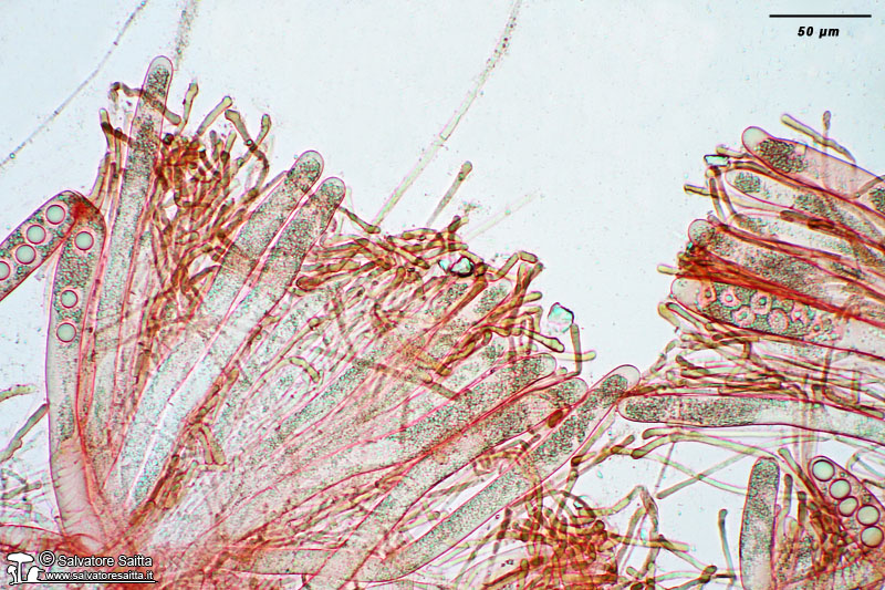 Helvella acetabulum aschi e parafisi foto 1