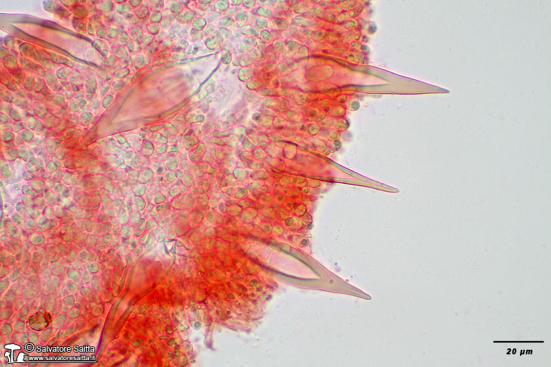 Hohenbuehelia petaloides cistidi foto 2