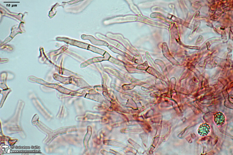 Lactarius aurantiacus pileipellis foto 2