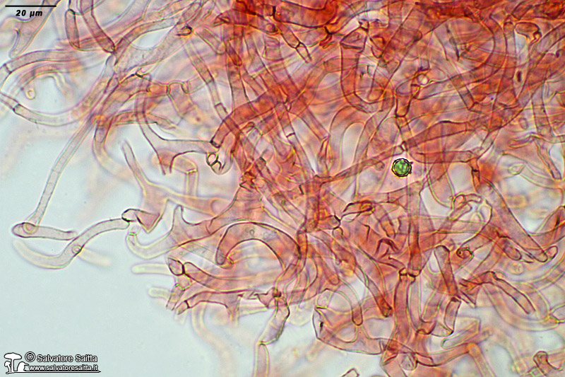 Lactarius aurantiacus pileipellis foto 5