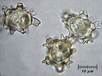 alycoperdoides_spore1 (26K)