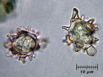 alycoperdoides_spore10 (24K)