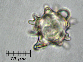 alycoperdoides_spore2 (21K)