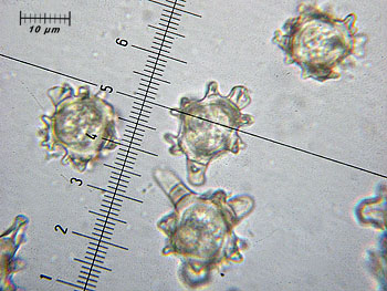 alycoperdoides_spore3 (35K)