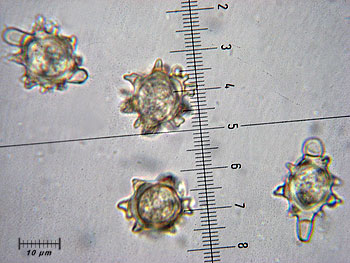 alycoperdoides_spore4 (30K)