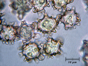 alycoperdoides_spore5 (32K)