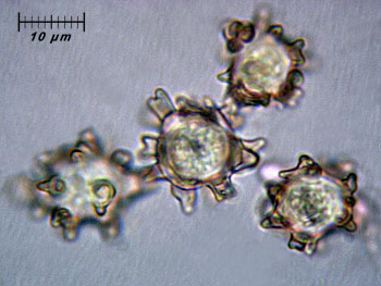 alycoperdoides_spore6 (24K)