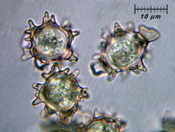 alycoperdoides_spore7 (28K)