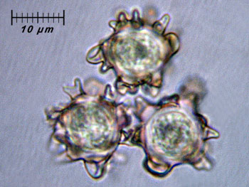 alycoperdoides_spore8 (25K)