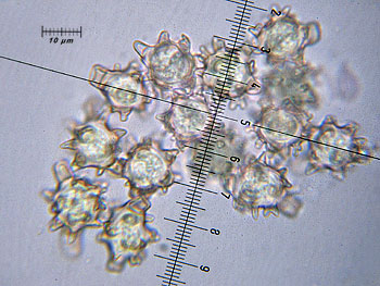 alycoperdoides_spore9 (37K)