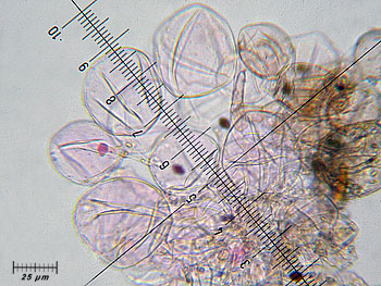 coprimicaceus_cutis3 (43K)
