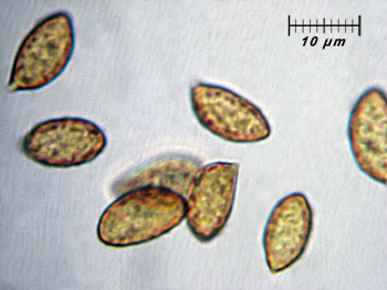corttrivialis_spore5 (24K)