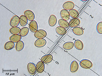 crepidcalolepis_spore4 (40K)
