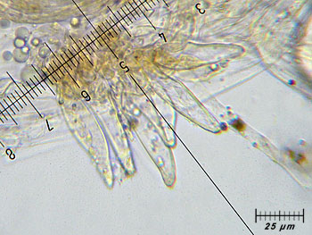 inoasterospora_caulo1 (38K)