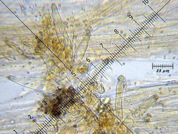 inoasterospora_caulo2 (45K)