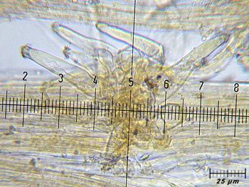 inoasterospora_caulo3 (43K)