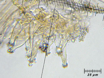 inoasterospora_caulo4 (35K)