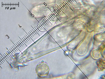inoasterospora_cheilo1 (34K)