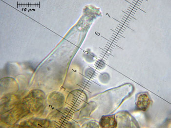 inoasterospora_cheilo2 (25K)