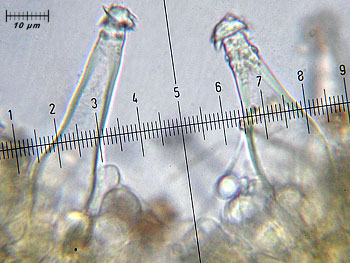 inoasterospora_cheilo3 (28K)