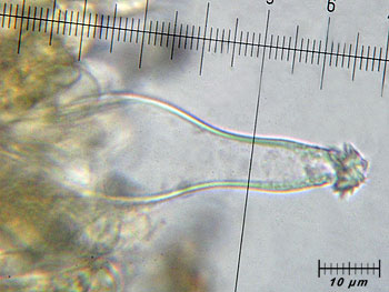 inoasterospora_cheilo4 (23K)