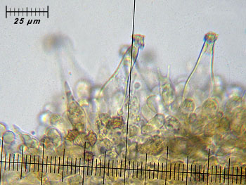 inoasterospora_cheilo5 (33K)