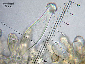 inoasterospora_cheilo6 (31K)