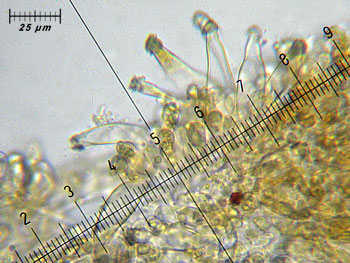 inoasterospora_cheilo7 (43K)