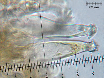 inoasterospora_cheilo8 (33K)