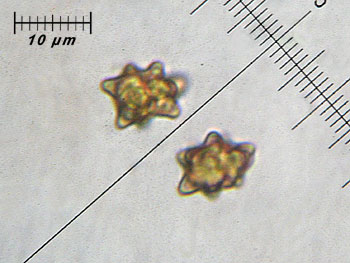 inoasterospora_spore1 (25K)