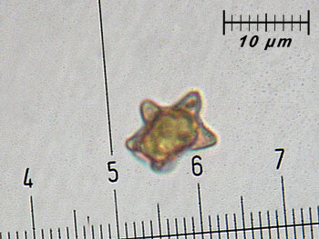 inoasterospora_spore2 (27K)