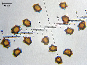 inoasterospora_spore3 (24K)