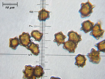 inoasterospora_spore4 (26K)