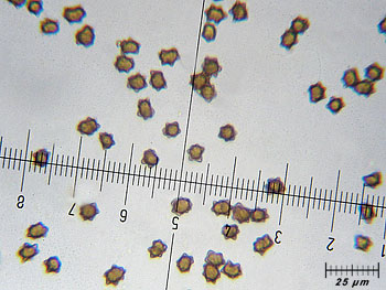 inoasterospora_spore5 (31K)
