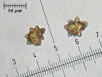 inoasterospora_spore6 (26K)