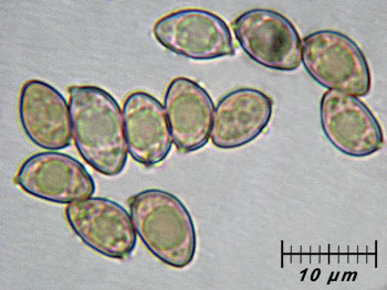 inoflocculosa_spore1 (27K)