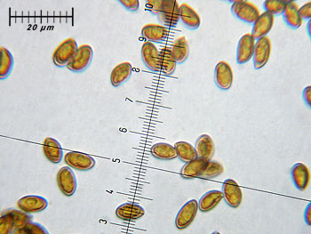 inogeophylla_spore2 (28K)