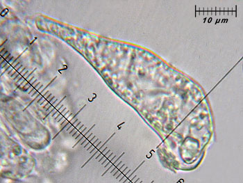 inomelanopus_pleuro2 (36K)