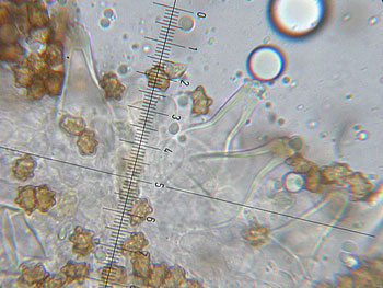 inomixtilis_cheilo7 (34K)