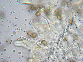 inomixtilis_cheilo8 (34K)