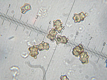 inomixtilis_spore2 (33K)