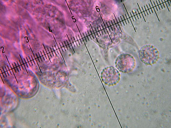 lacc_affinis_basidi1 (38K)