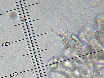lacc_affinis_basidi4 (36K)