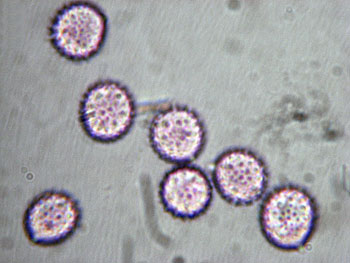 lacc_affinis_spore4 (25K)