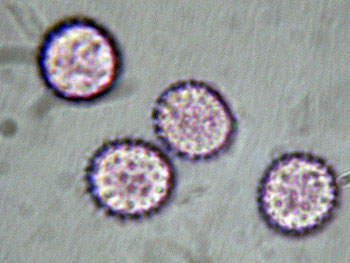 lacc_affinis_spore5 (30K)