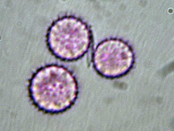 lacc_affinis_spore8 (31K)