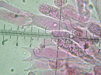 lacc_lateritia_basidi8 (36K)