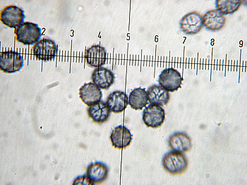 lact_subumbonatus_spore1 (31K)